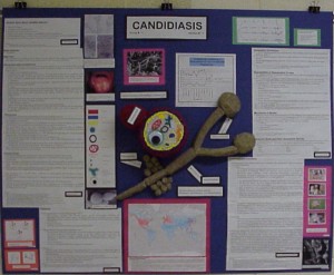 Example Two